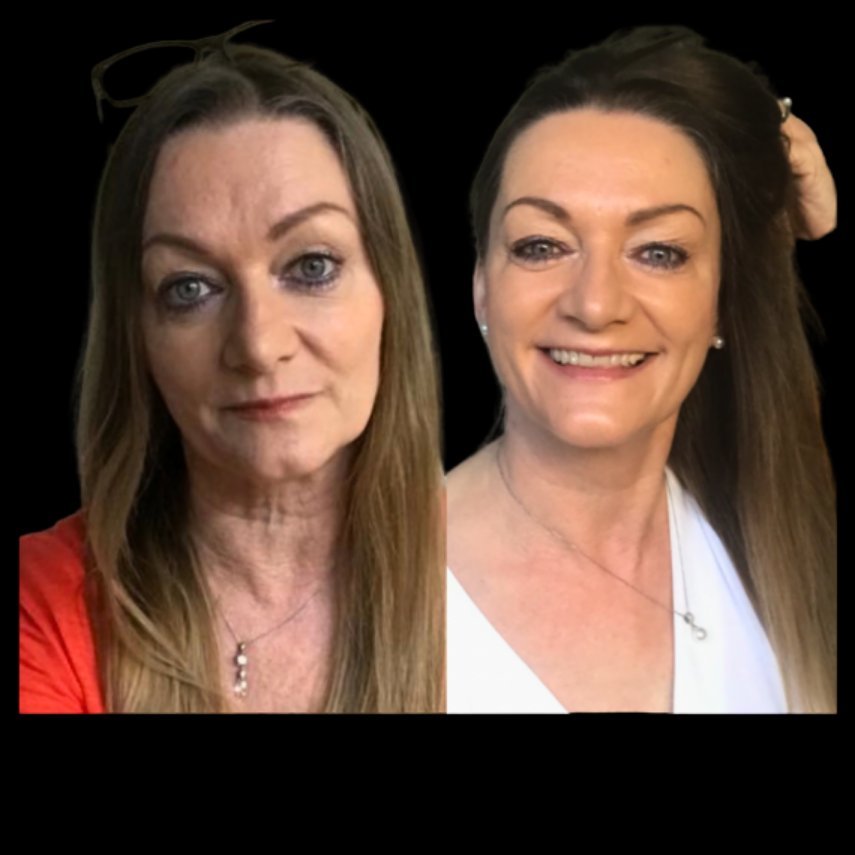 Chi statt Botox Vorher Nachher – Echte Ergebnisse nach Gesichtsyoga mit Christina Schmid